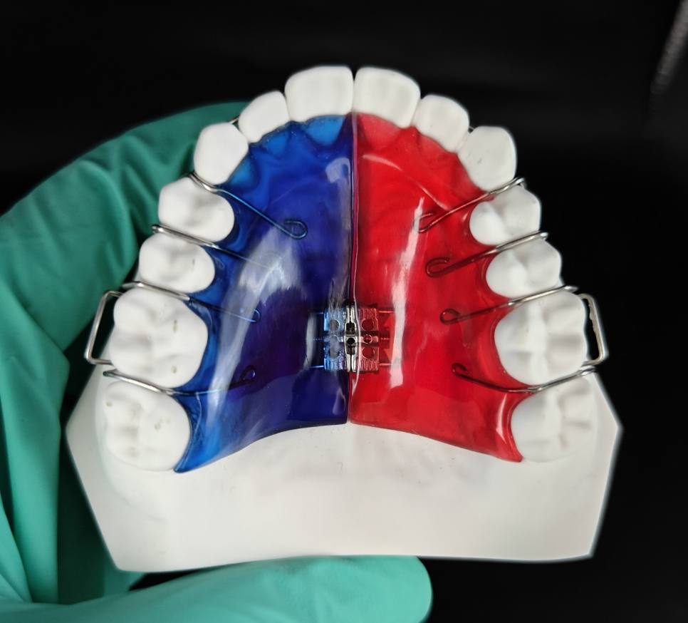 2 way expander