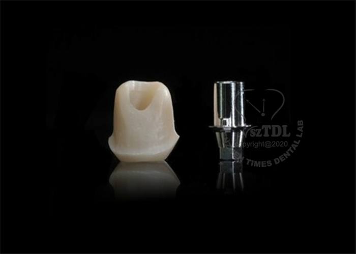 Custom abutment