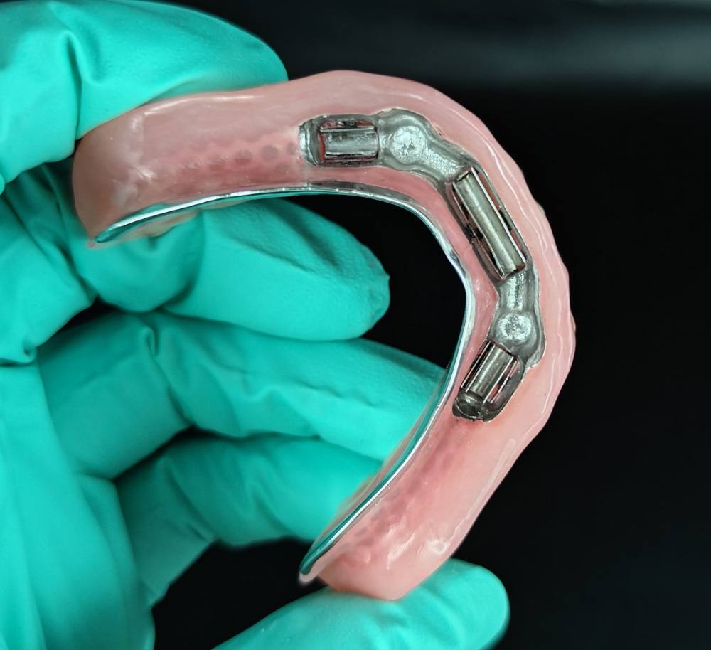 Implant bar