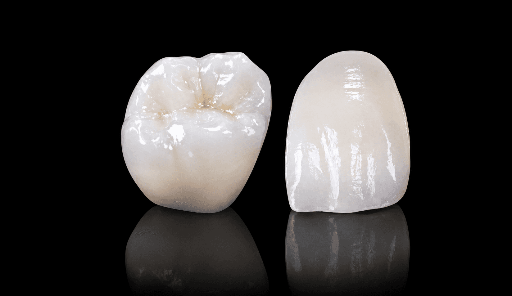 E.max Full Ceramic