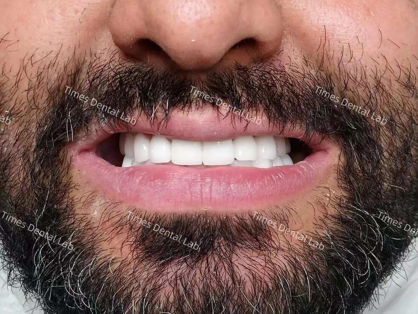 صورة موارد مختبر الأسنان صحيحة