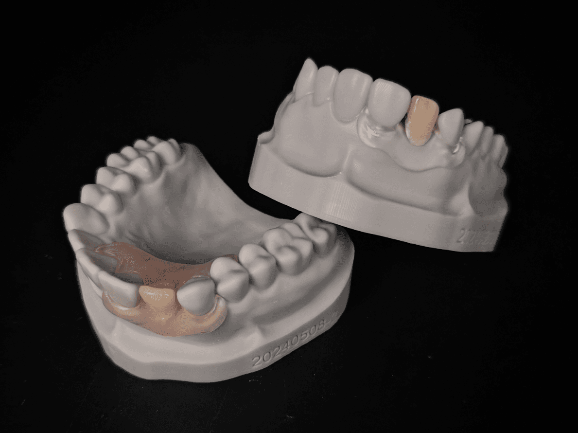 Removable Denture Lab Outsourcing: A Case Submission Checklist