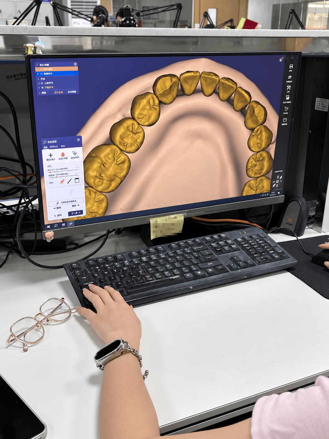 Digital denture tooth setup on a design workstation