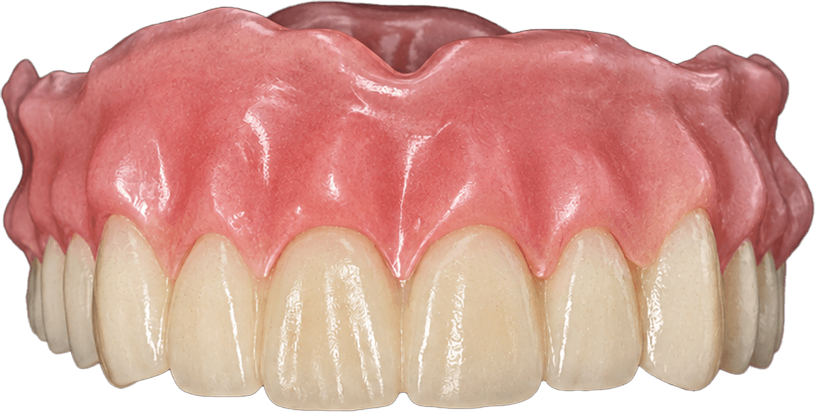 Finished milled full denture