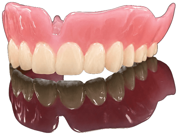 Printed full denture produced by Times Dental Lab