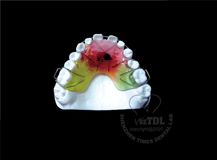 Maintaining Dental Health with the Hawley Retainer: A Blend of Functionality and Style