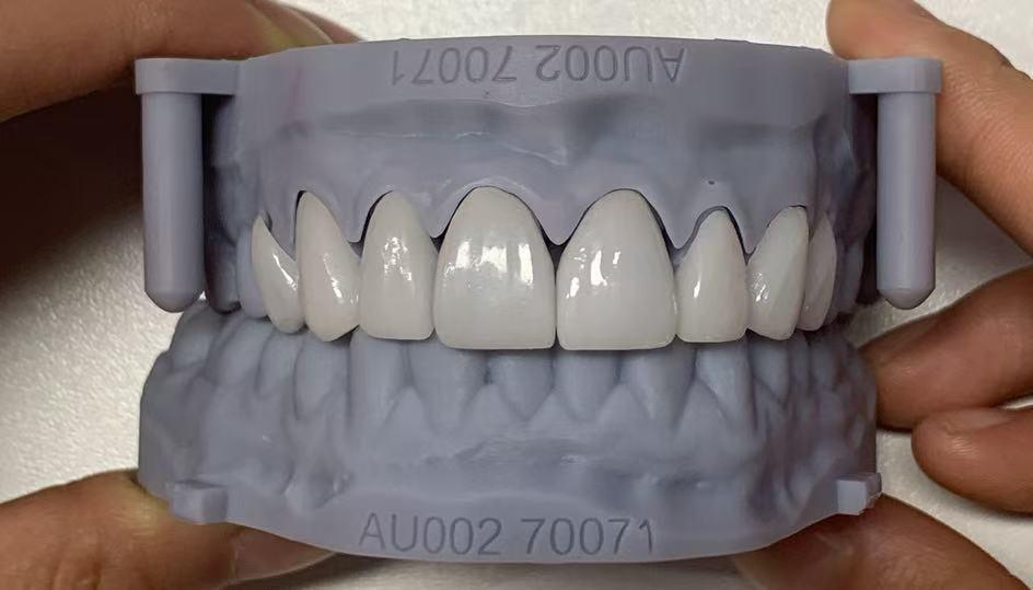 如何评估 Times Dental Lab 的试用订单